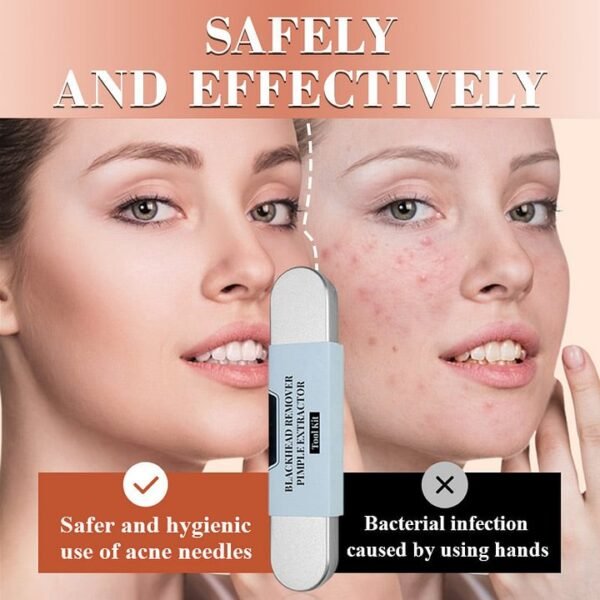💓Last day discount💥Medical grade blackhead cell clip tool set - Image 2