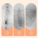 💦✨ Reusable waterproof silicone scar patch! Making scars invisible is not a dream ✨💦!