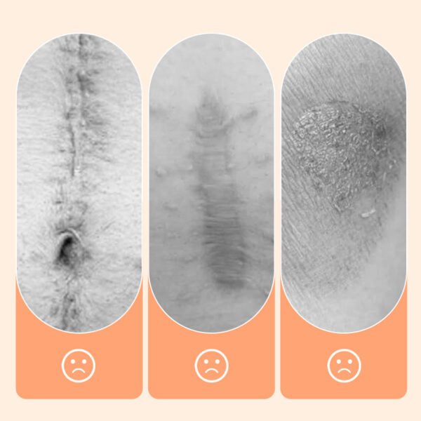 💦✨ Reusable waterproof silicone scar patch! Making scars invisible is not a dream ✨💦! - Image 4